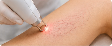Lesiones Vasculares